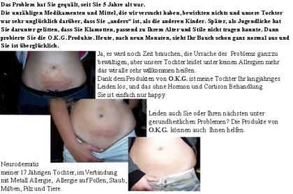 Sie leiden unter Übergewicht Allergien Exzemen oder unter anderen gesundheitli