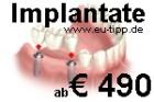 ZAHN-Behandlung CZ -günstiger als Ungarn- Implantate 490 Euro